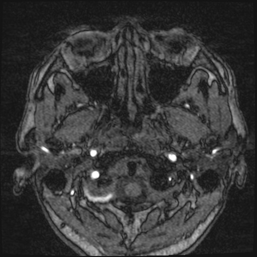 Click on the Serie image to view the images of VILLANUEVA, WILLIAM A.